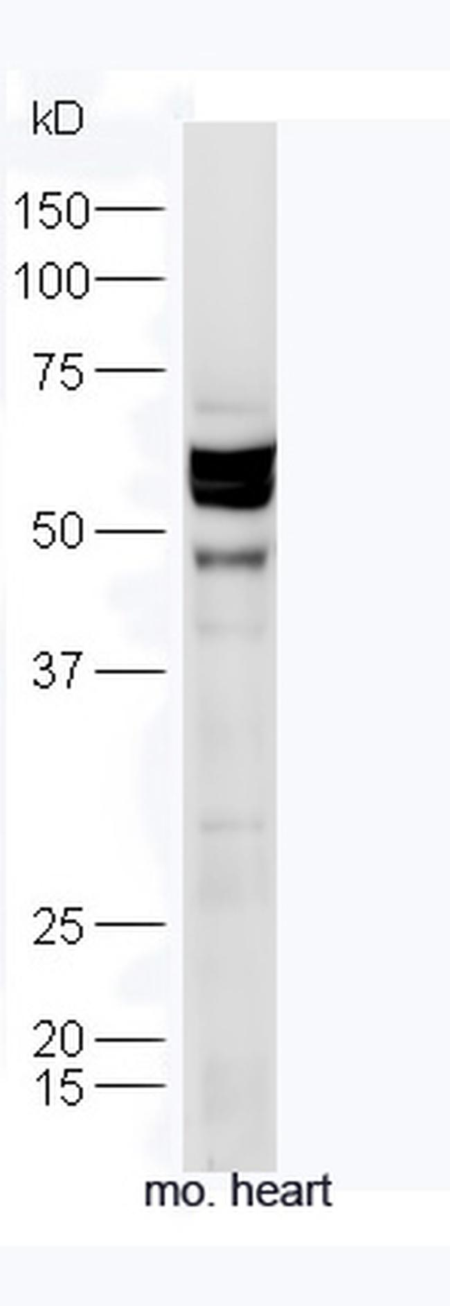 TXA2R Antibody in Western Blot (WB)