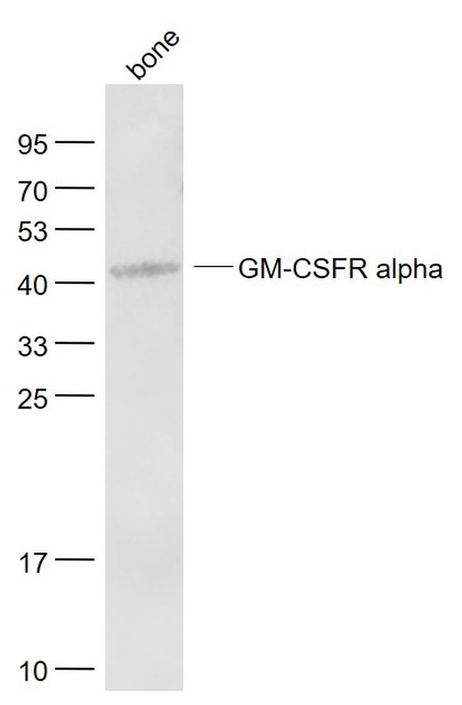 GM-CSFR alpha Antibody in Western Blot (WB)