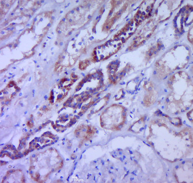 CSF3 Antibody in Immunohistochemistry (Paraffin) (IHC (P))