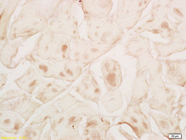 MYPN Antibody in Immunohistochemistry (Paraffin) (IHC (P))