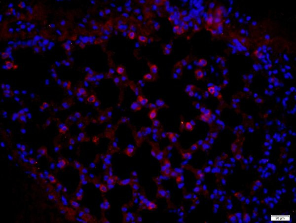 Pan Cytokeratin/p-CK Antibody in Immunohistochemistry (Paraffin) (IHC (P))