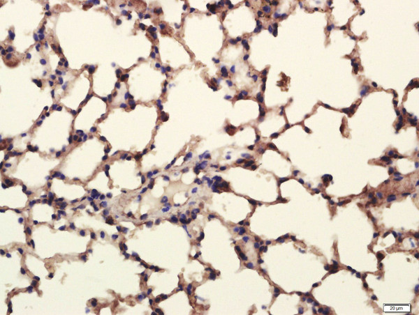 Pan Cytokeratin/p-CK Antibody in Immunohistochemistry (Paraffin) (IHC (P))