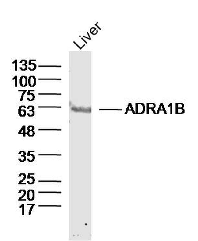 ADRA1B Antibody in Western Blot (WB)