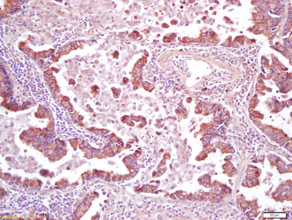 CD200R Antibody in Immunohistochemistry (Paraffin) (IHC (P))