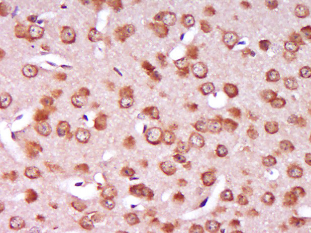 SLC27A1 Antibody in Immunohistochemistry (Paraffin) (IHC (P))