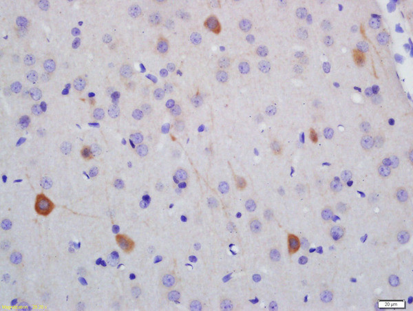 NF-H Antibody in Immunohistochemistry (Paraffin) (IHC (P))