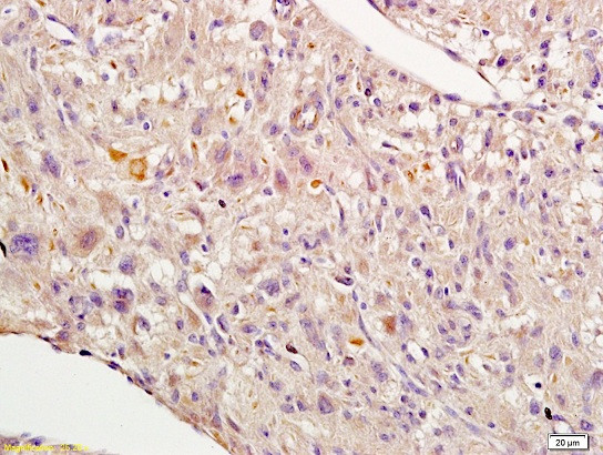 Nrf2 Antibody in Immunohistochemistry (Paraffin) (IHC (P))