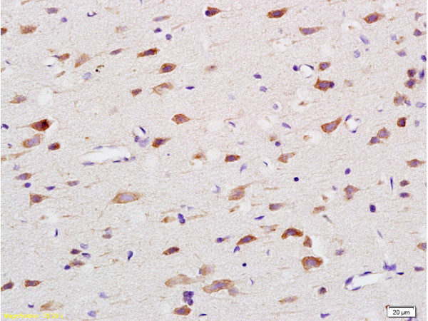 NADPH oxidase 4 Antibody in Immunohistochemistry (Paraffin) (IHC (P))