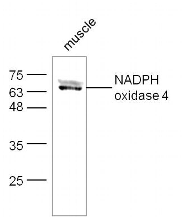 NADPH oxidase 4 Antibody in Western Blot (WB)
