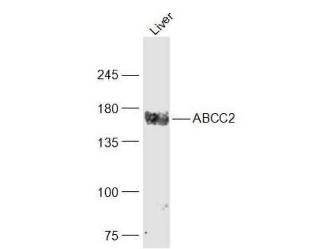 MRP2 Antibody in Western Blot (WB)