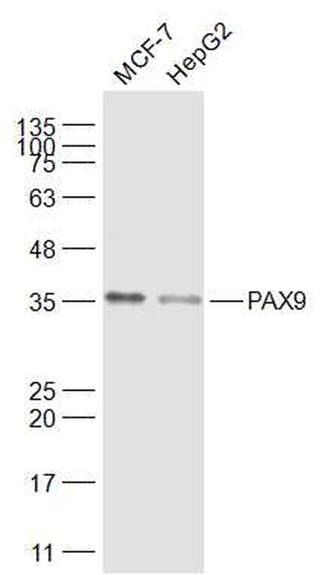 PAX9 Antibody in Western Blot (WB)