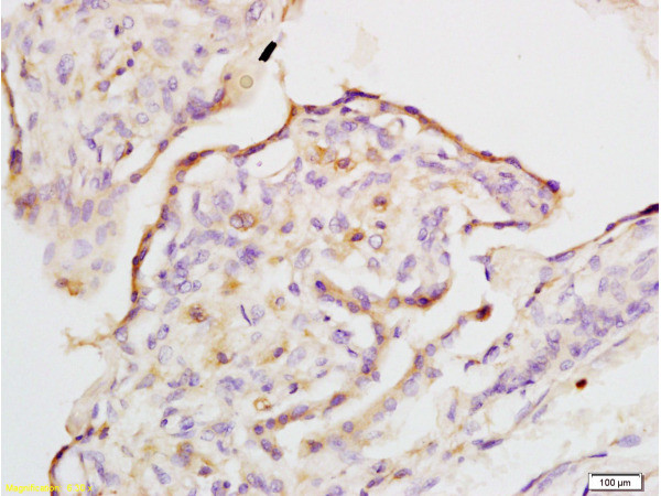 IQGAP1 Antibody in Immunohistochemistry (Paraffin) (IHC (P))