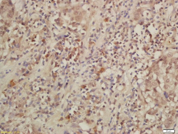 IL-28R Antibody in Immunohistochemistry (Paraffin) (IHC (P))