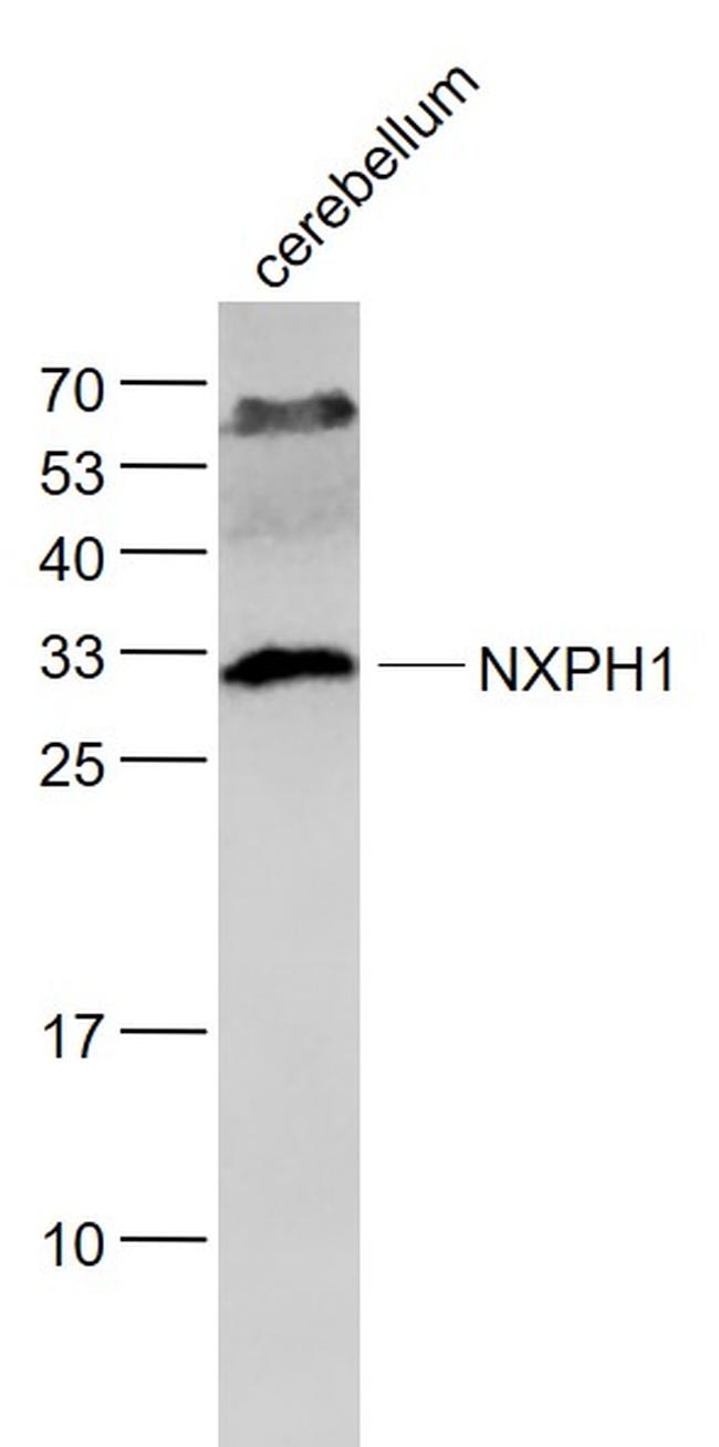 NXPH1 Antibody in Western Blot (WB)