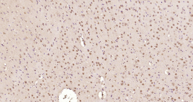 Ataxin 7 Antibody in Immunohistochemistry (Paraffin) (IHC (P))