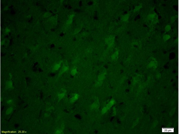 SNAP25 Antibody in Immunohistochemistry (Paraffin) (IHC (P))