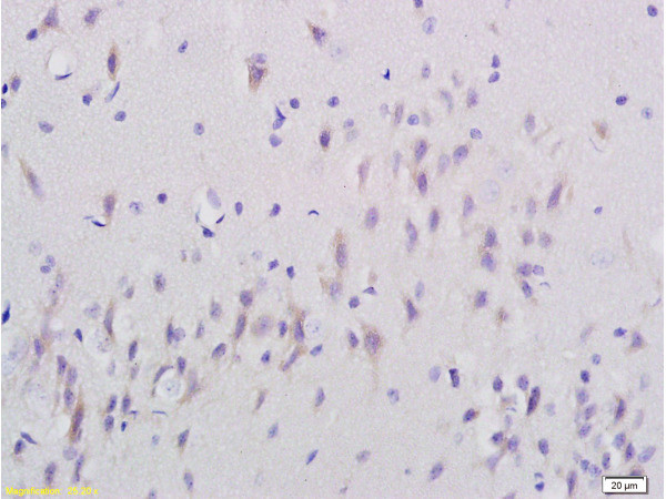 SNAP25 Antibody in Immunohistochemistry (Paraffin) (IHC (P))