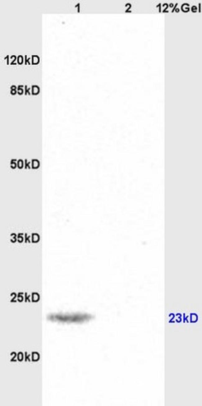 SNAP25 Antibody in Western Blot (WB)