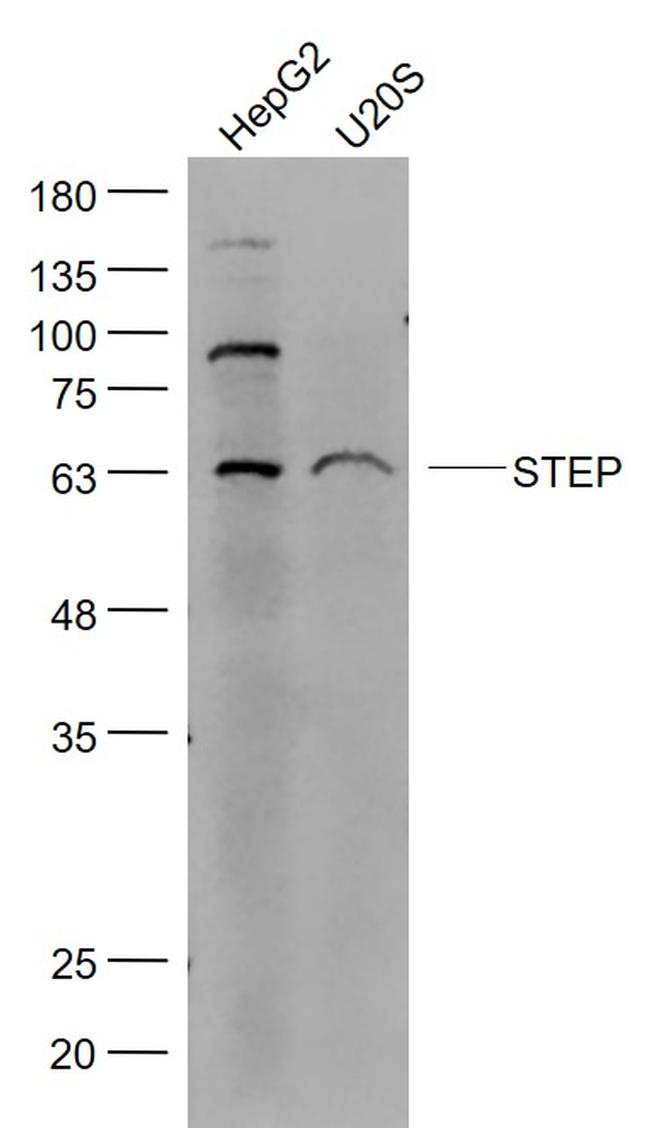 PTPN5/STEP Antibody in Western Blot (WB)