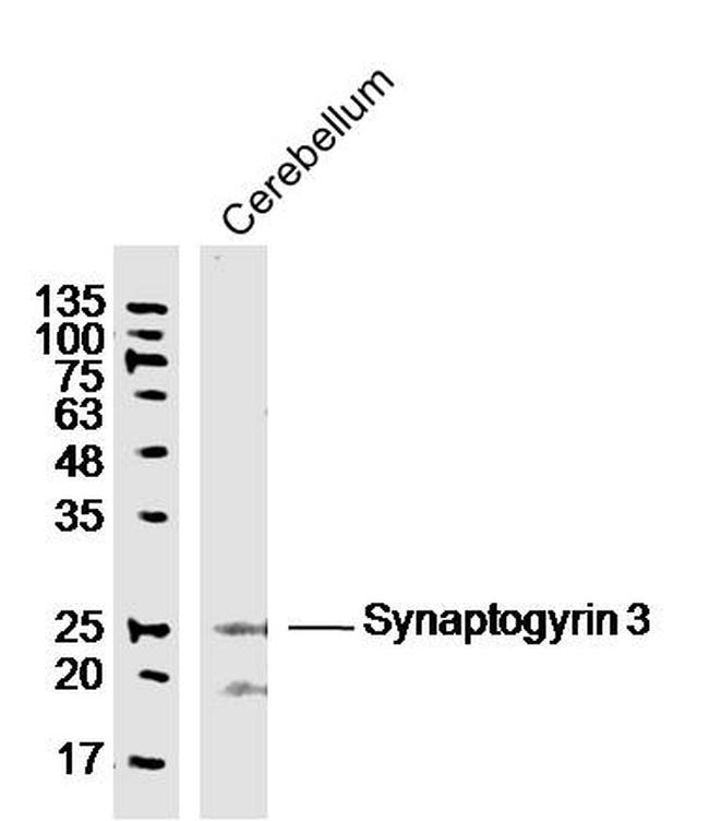 Synaptogyrin 3 Antibody in Western Blot (WB)