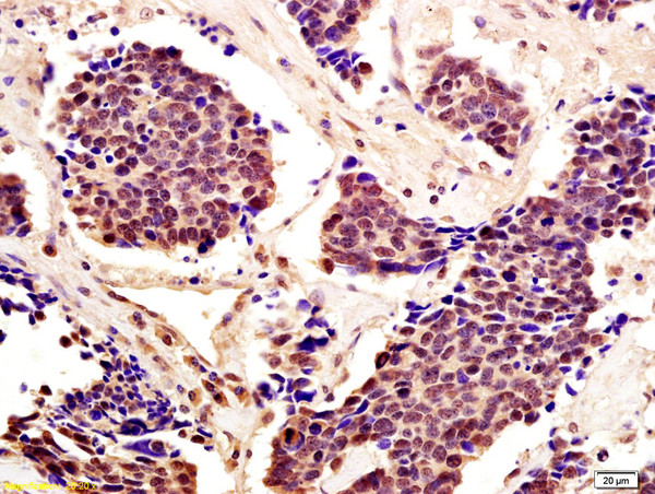 STAT5 Antibody in Immunohistochemistry (Paraffin) (IHC (P))