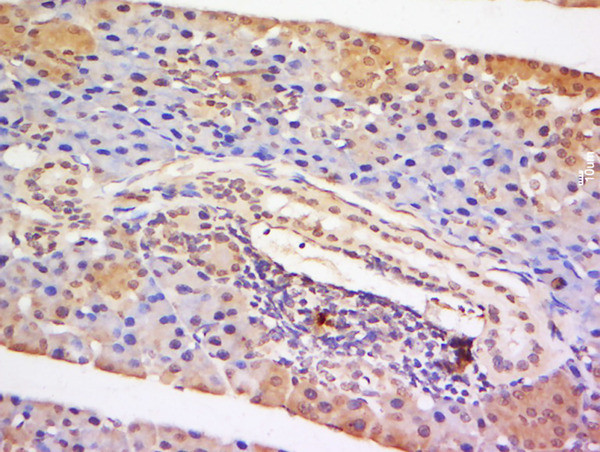 STAT5 Antibody in Immunohistochemistry (Paraffin) (IHC (P))