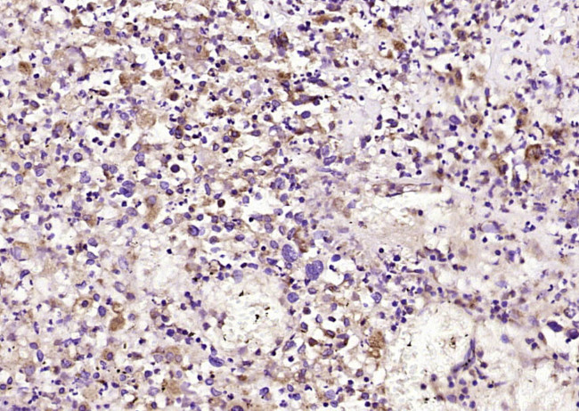 STAT5 Antibody in Immunohistochemistry (Paraffin) (IHC (P))