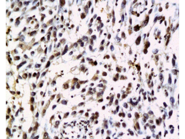 NRAS Antibody in Immunohistochemistry (Paraffin) (IHC (P))