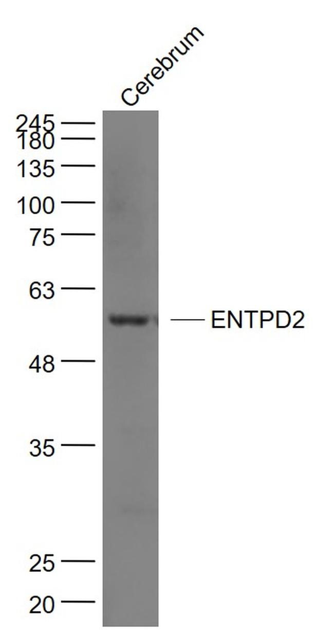ENTPD2/CD39L1 Antibody in Western Blot (WB)