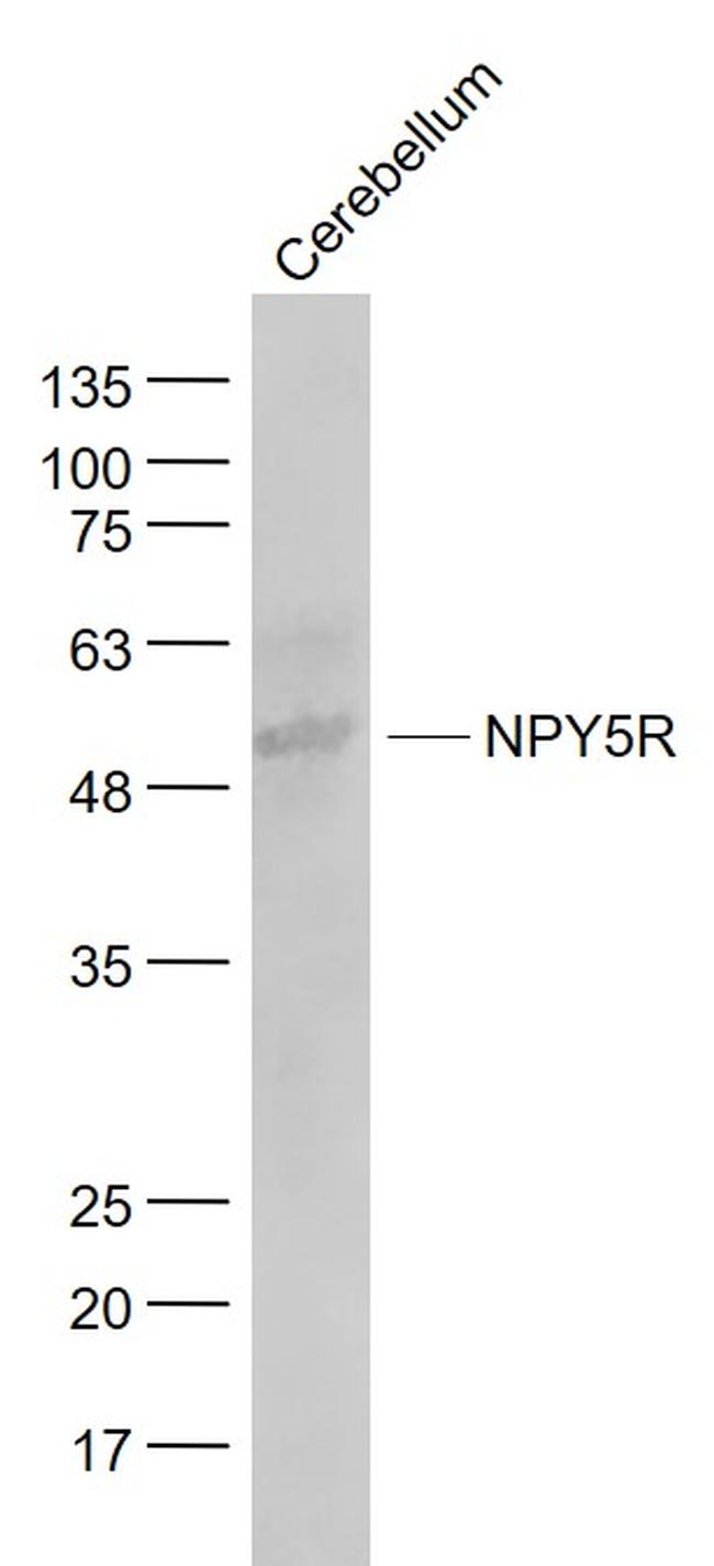 NPY5R Antibody in Western Blot (WB)