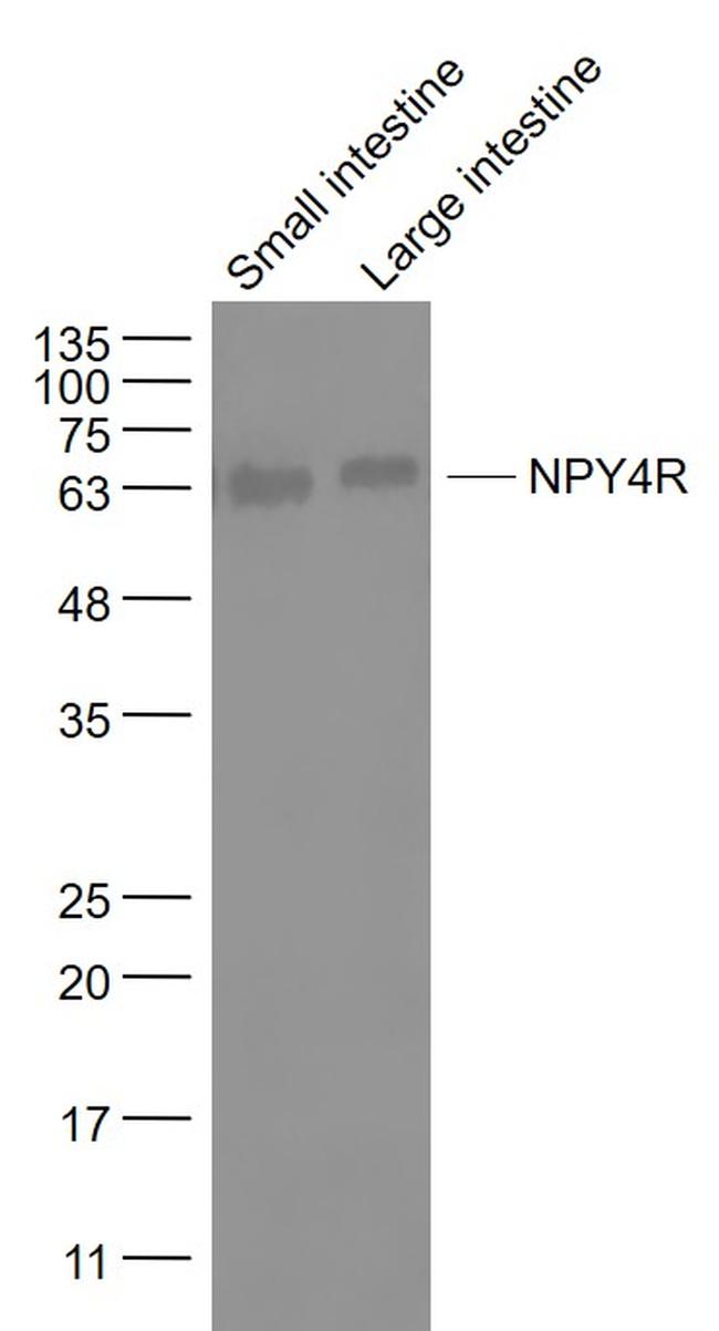 NPY4R Antibody in Western Blot (WB)