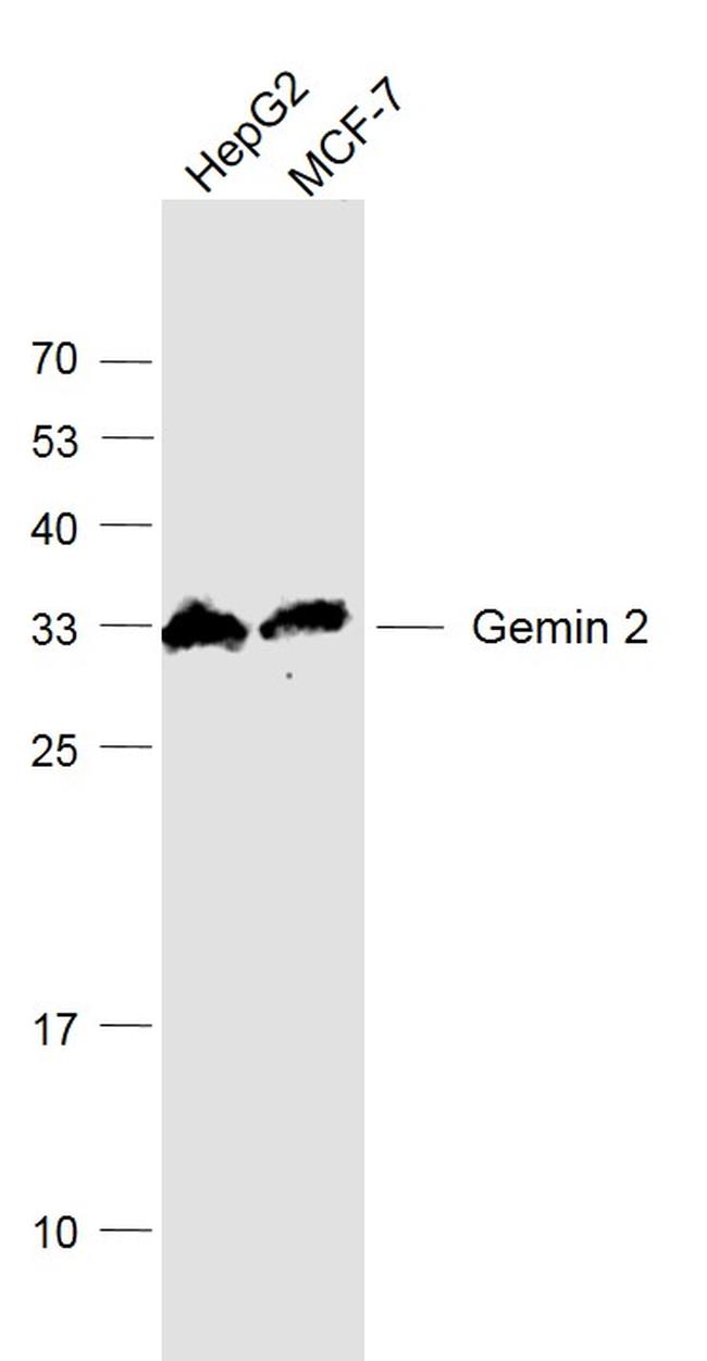 Gemin 2/SMA Antibody in Western Blot (WB)