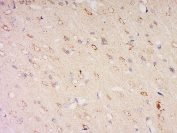 CLN8 Antibody in Immunohistochemistry (Paraffin) (IHC (P))