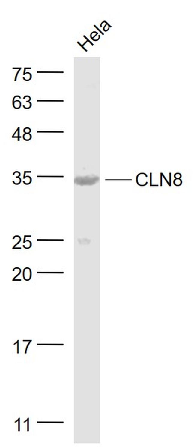 CLN8 Antibody in Western Blot (WB)
