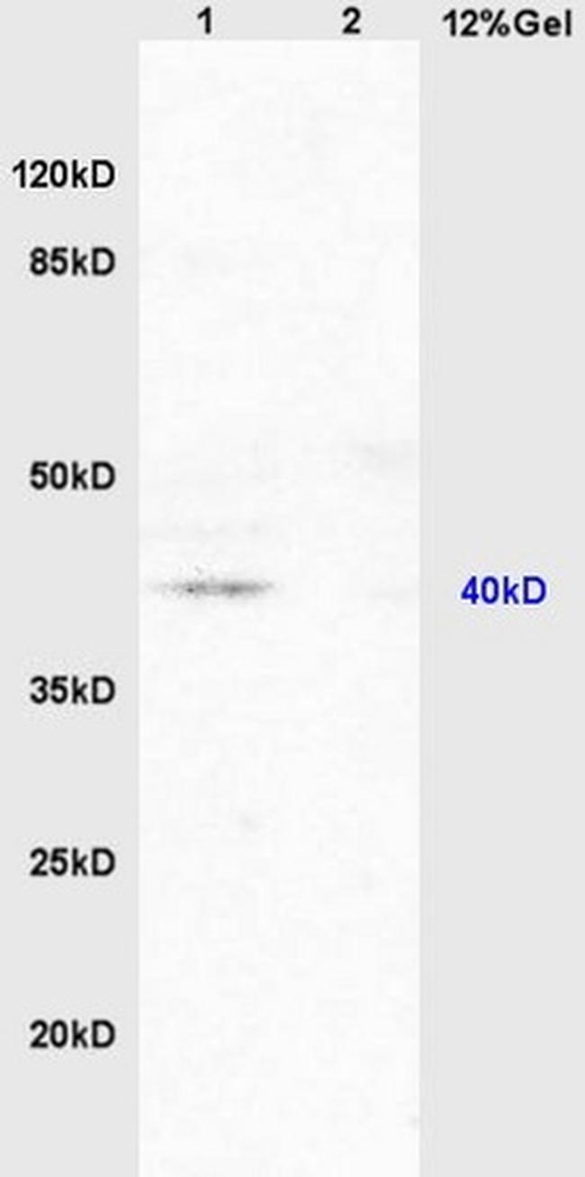 PAR-2 Antibody in Western Blot (WB)