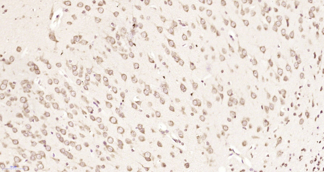 CSAD Antibody in Immunohistochemistry (Paraffin) (IHC (P))