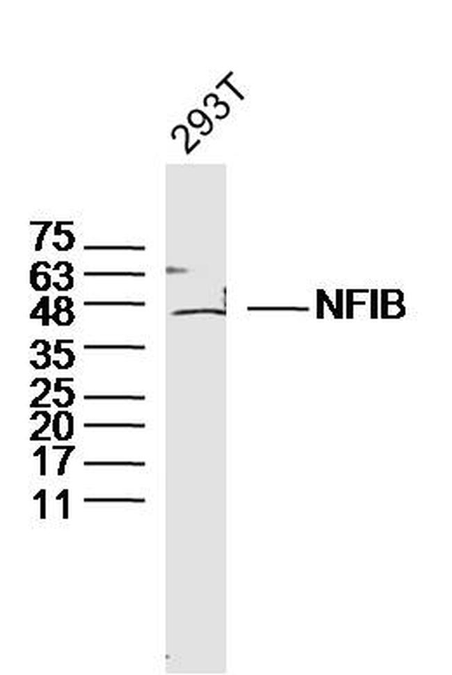 NFIB/NF1B2 Antibody in Western Blot (WB)