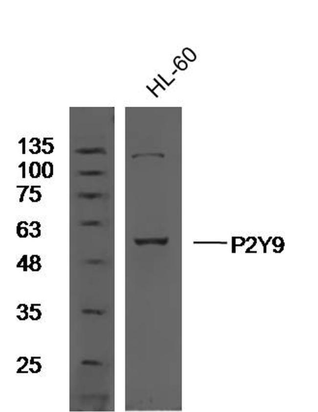 P2Y9 Antibody in Western Blot (WB)