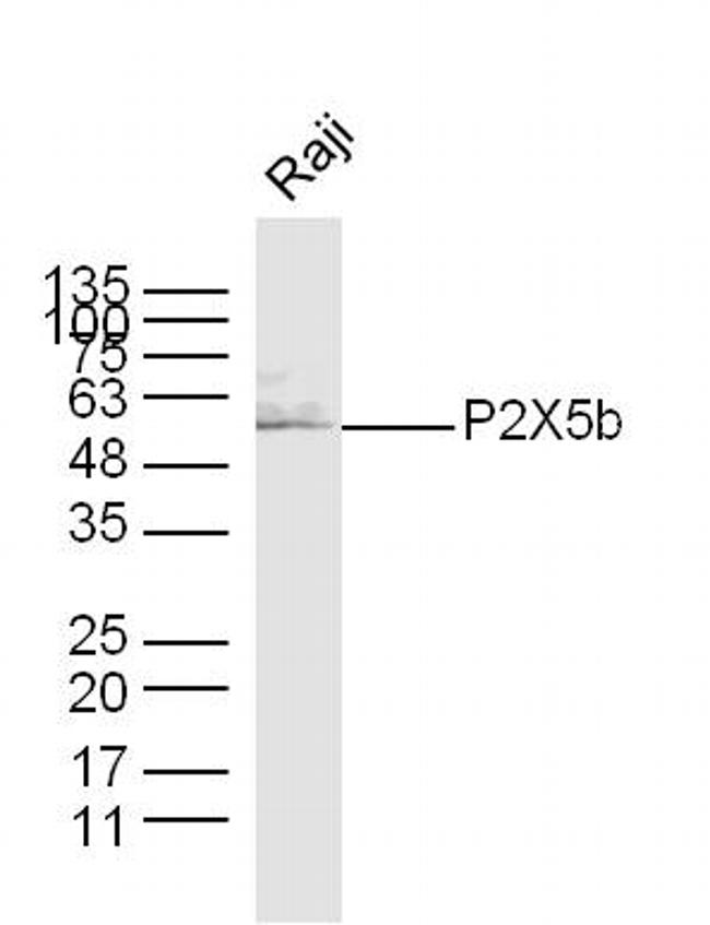 P2X5b Antibody in Western Blot (WB)