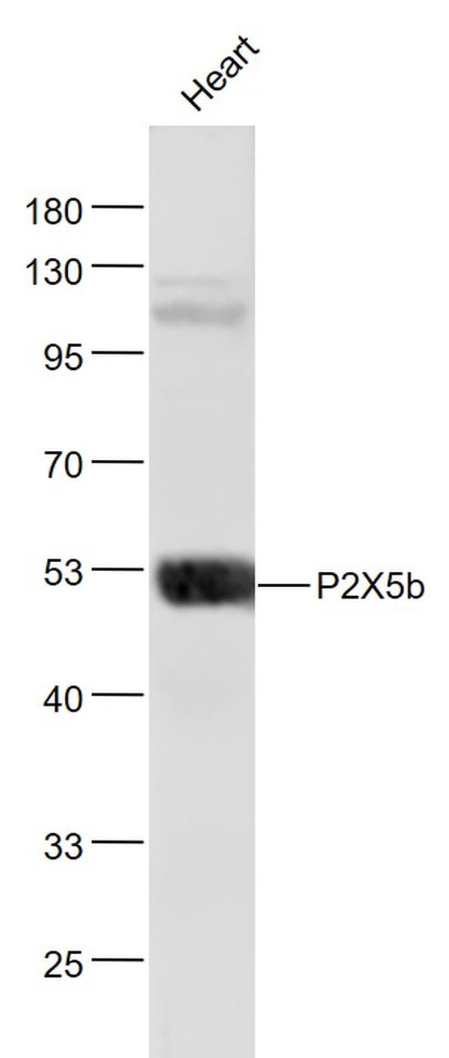 P2X5b Antibody in Western Blot (WB)