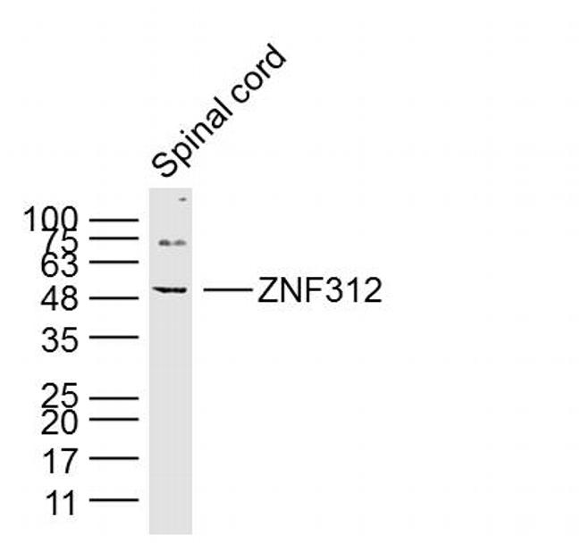 ZNF312 Antibody in Western Blot (WB)