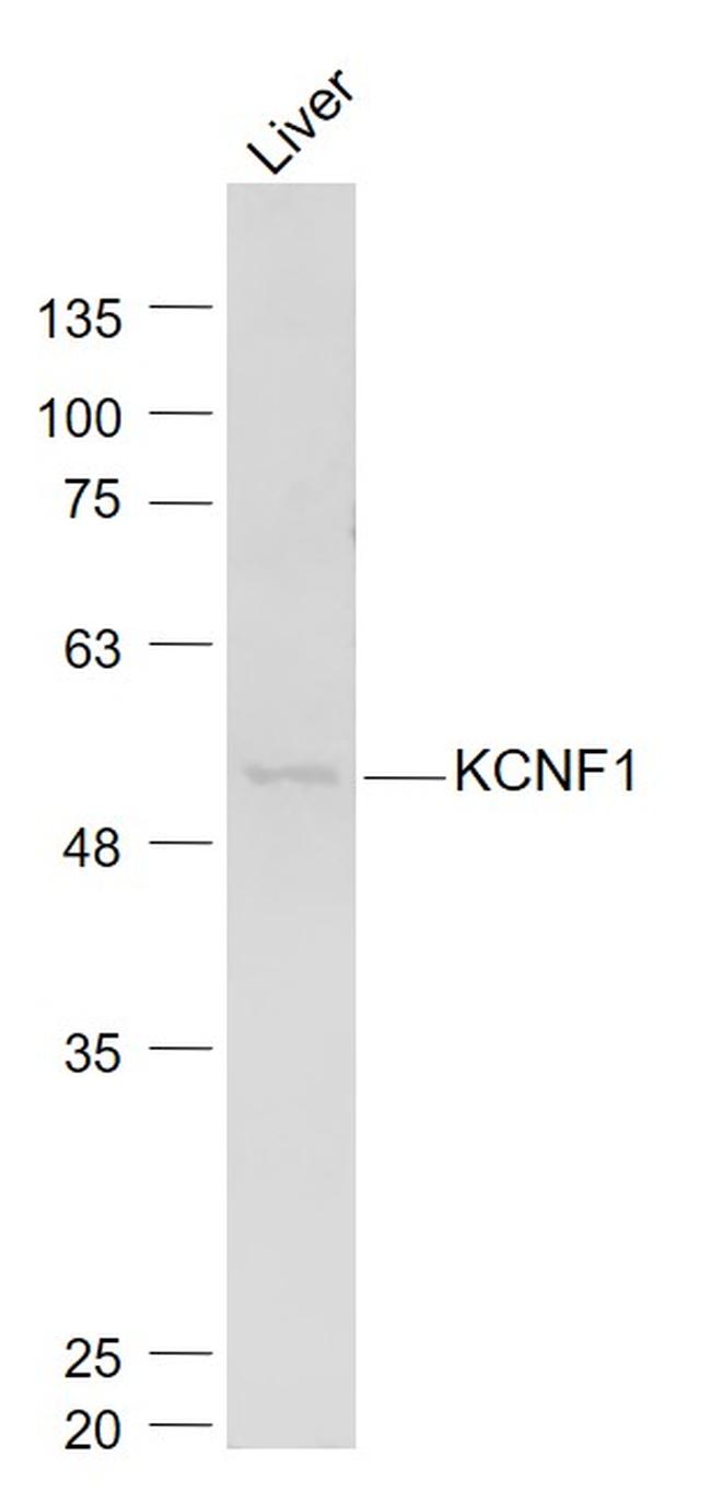 KCNF1 Antibody in Western Blot (WB)