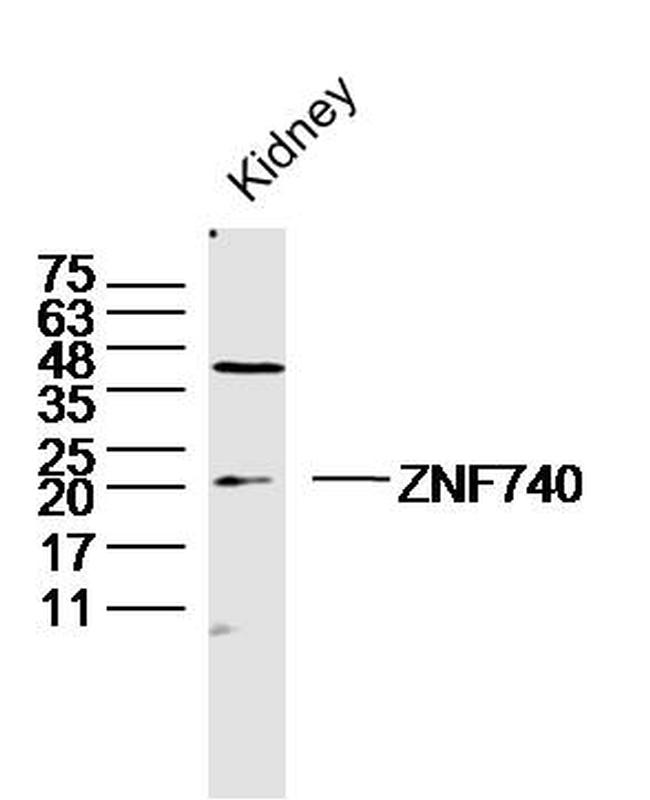 ZNF740 Antibody in Western Blot (WB)