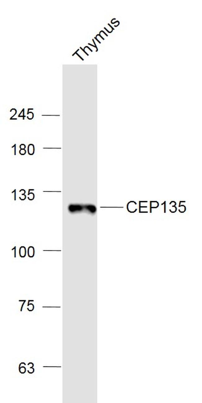 CEP135 Antibody in Western Blot (WB)