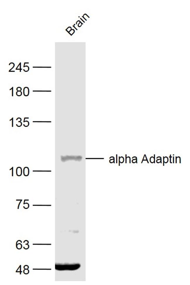 alpha2 Adaptin Antibody in Western Blot (WB)