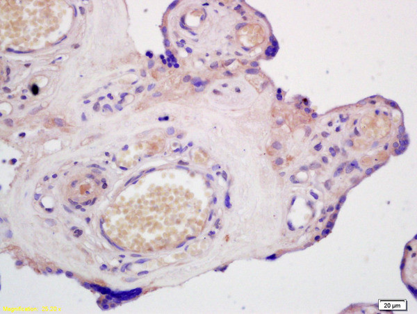 ABCG1 Antibody in Immunohistochemistry (Paraffin) (IHC (P))