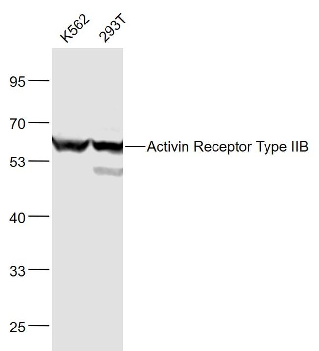 ACVR2B/ACTR2B Antibody in Western Blot (WB)