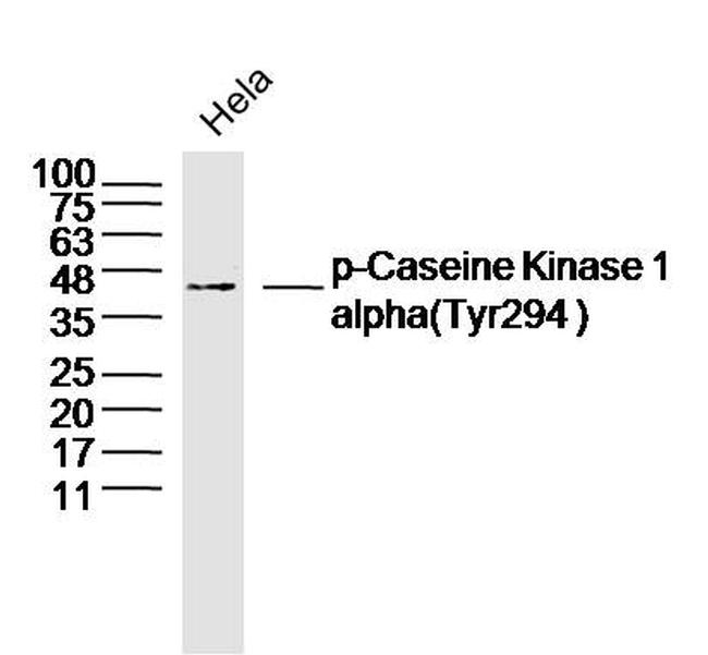 Phospho-Casein Kinase 1 alpha (Tyr294) Antibody in Western Blot (WB)