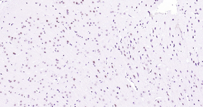 API5 Antibody in Immunohistochemistry (Paraffin) (IHC (P))