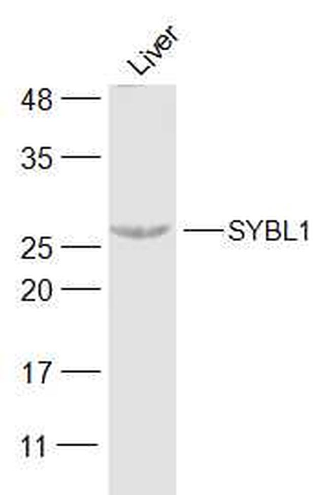 SYBL1 Antibody in Western Blot (WB)